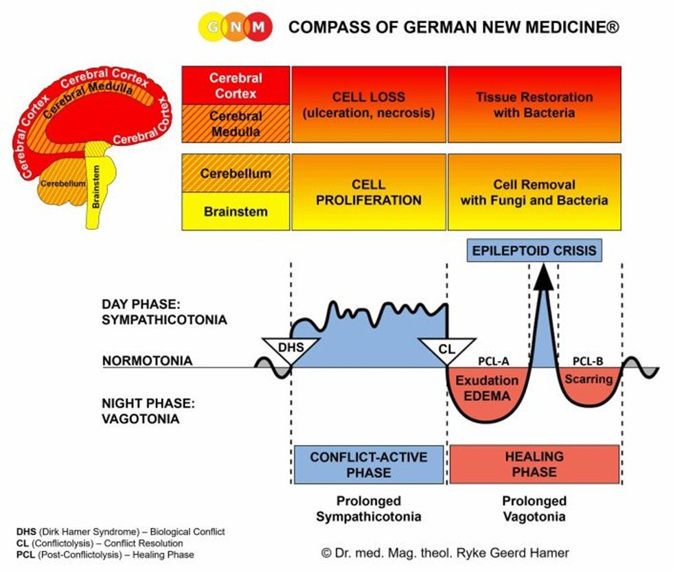 German New Medicine